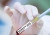 Coronavirus � Nella vicina Robbio sperimentato con successo un innovativo test sierologico