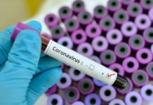Coronavirus – A Vercelli registrati 5 nuovi decessi, ma ci sono anche cinque guariti